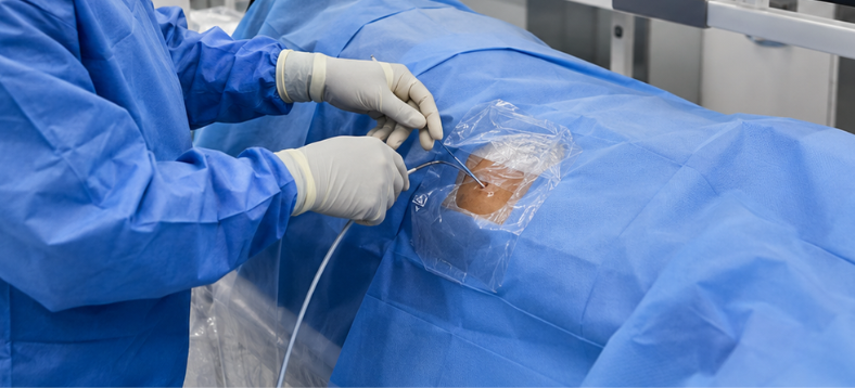 Atherectomy