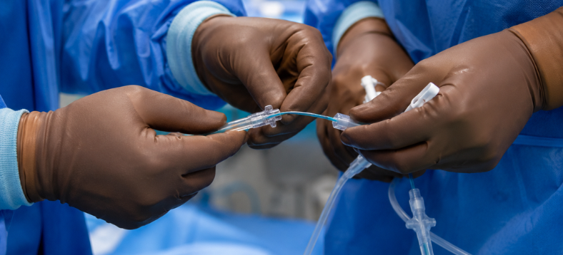 Catheter-Directed Thrombolysis