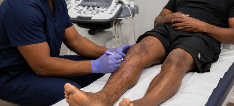 vein marking