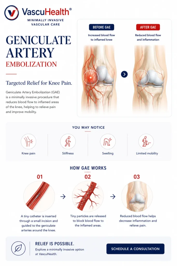 How Genicular Artery Embolization Relieves Knee Osteoarthritis Pain