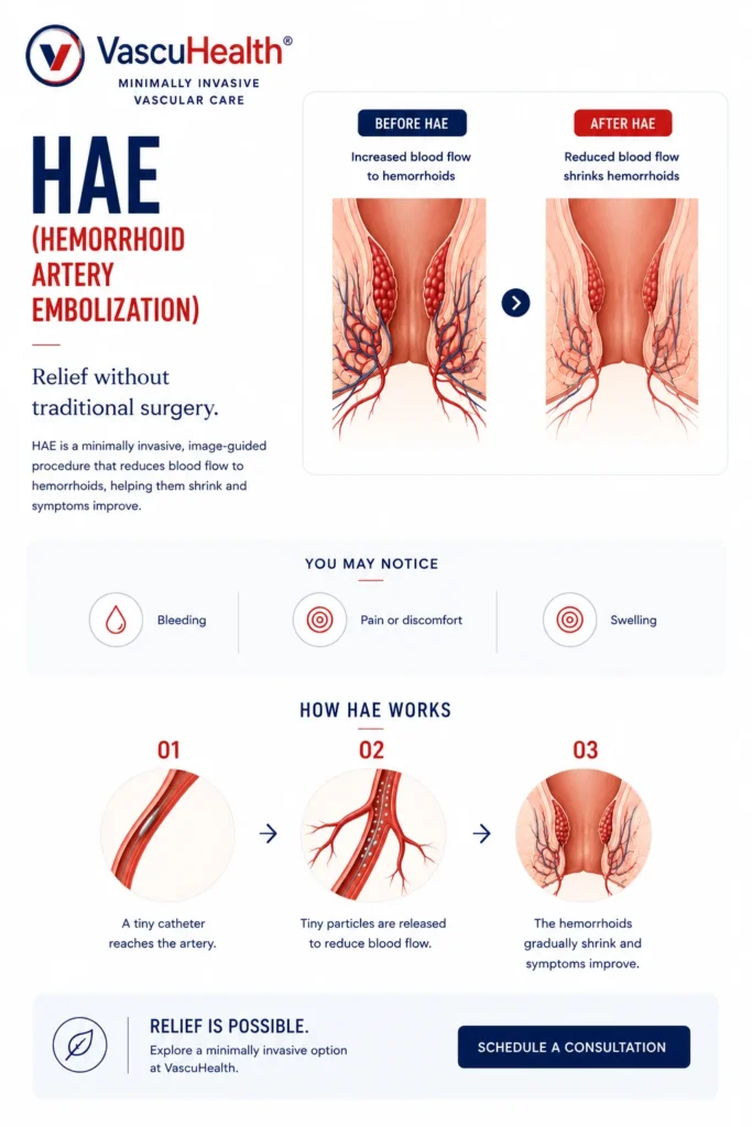 ABOUT THE PROCEDURE How the Hemorrhoid Artery Embolization Procedure Works
